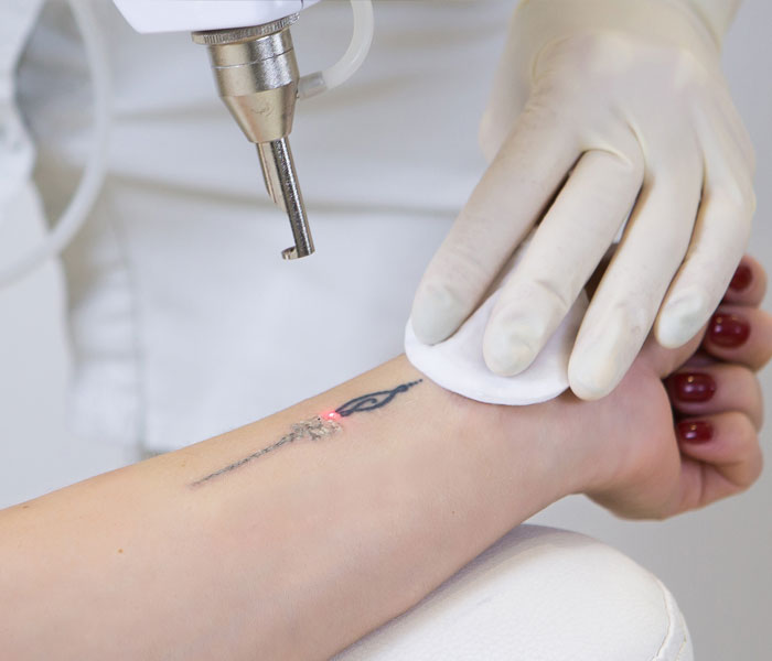 General Surgery